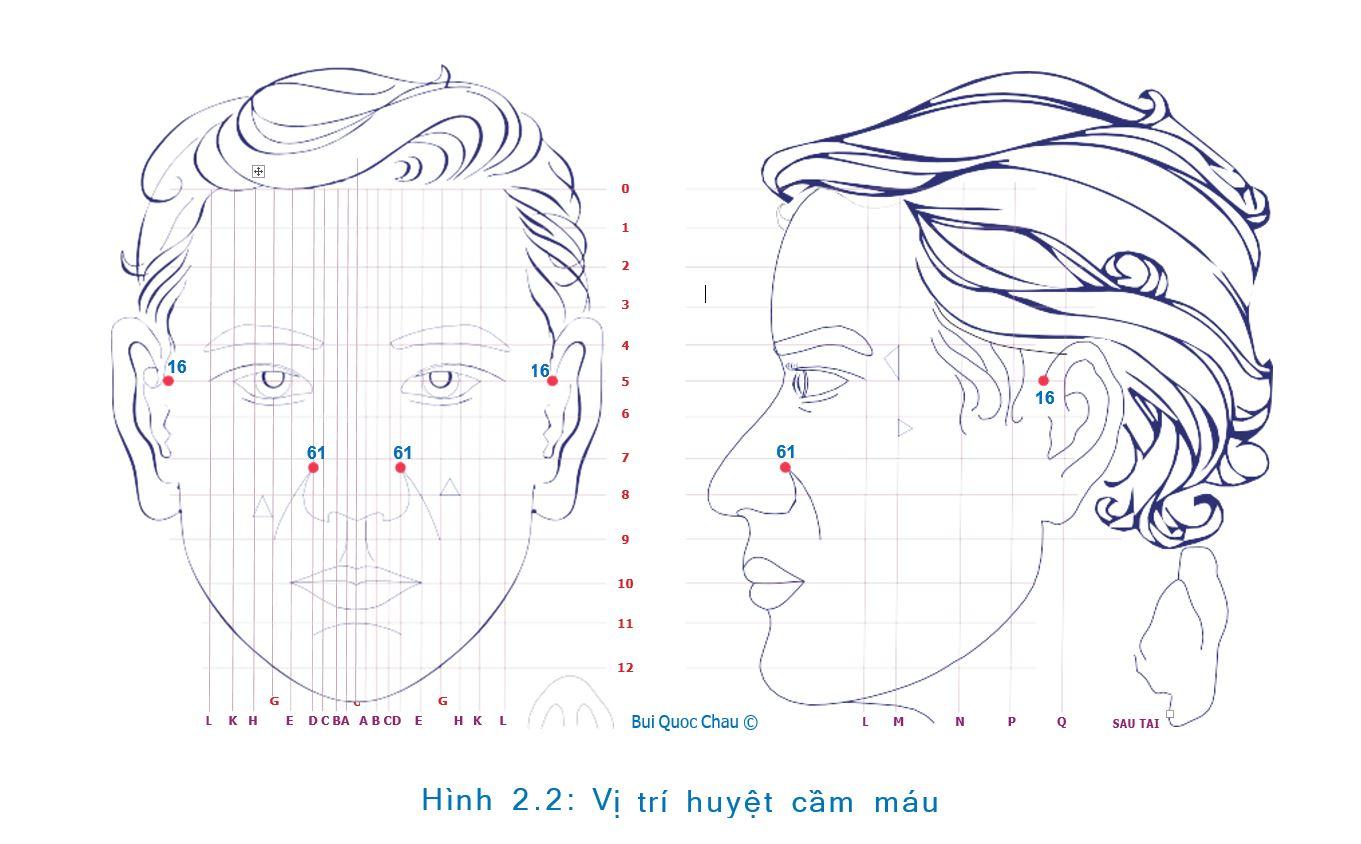 Cầm máu bằng diện chẩn-1